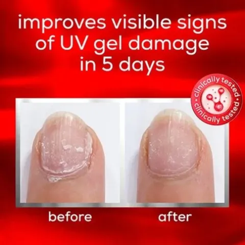 Essie To The Rescue Tratamento Reparador De Unhas