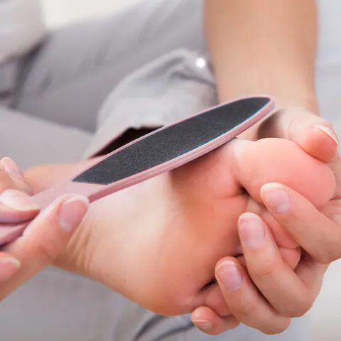 Kiepe Removedor De Calosidades