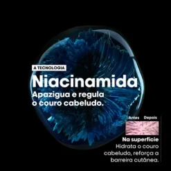 L’Oréal Pro Serie Expert Scalp Advanced Champô Antidesconforto