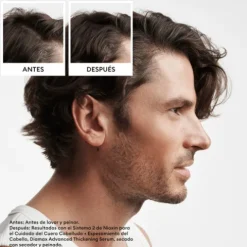 Nioxin Kit Sistema 2 Para Cabelo Natural Com Perda De Densidade