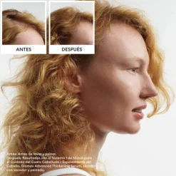 Nioxin Kit Sistema 1 Para Cabelo Fino Com Perda De Densidade