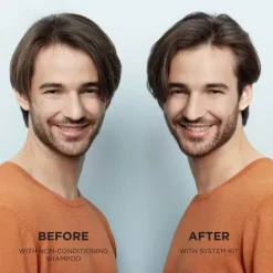 Nioxin Sistema 2 Condicionador Para Cabelo Natural Com Perda Densidade